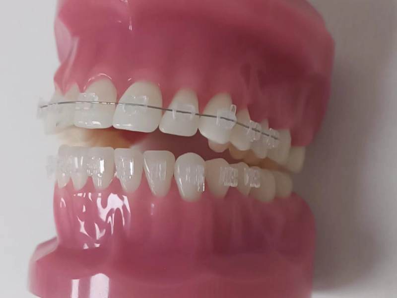 סמכים שקופים