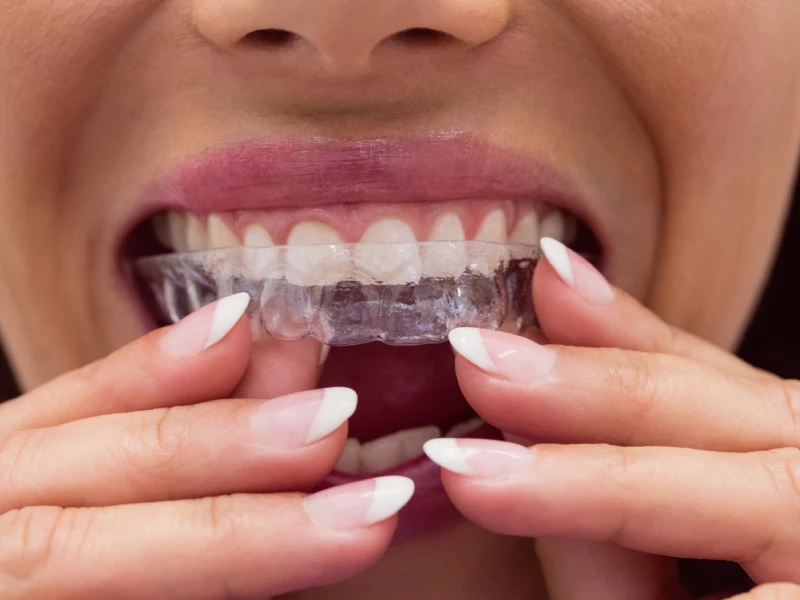 קשתיות שקופות מגמות ויעילות